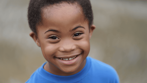 Trisomie 21 chez une personne noire : réalités médicales et sociales enfant-trisomique-noir